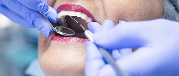 Best Emergency Treatment for Dental Infections or Abscesses in Paulina, LA